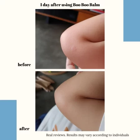 A For Apothecary Boo Boo Balm - Image 4