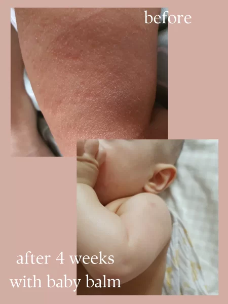 A for Apothecary Multi Purpose Baby Balm Stick - Image 7