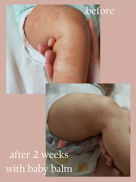 A for Apothecary Multi Purpose Baby Balm Stick - Image 6